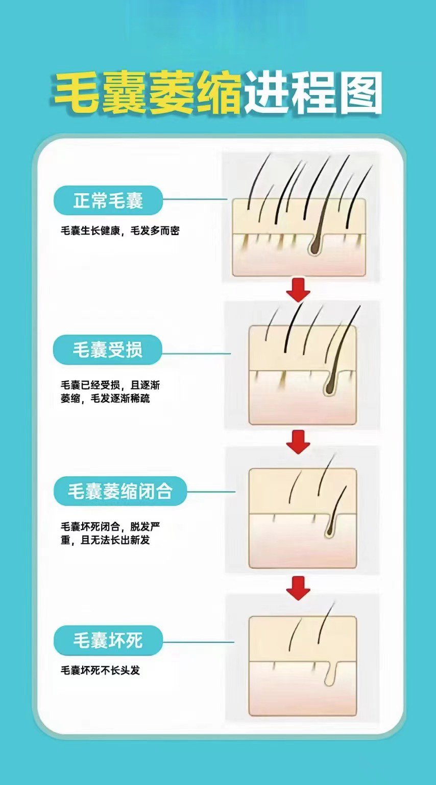 毛囊退化图片