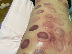 -沈师傅盲人按摩工作室(密三小区店)