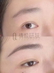 -倩极·精研痘敏肌管理