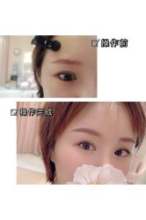 -UP&UP·半永久眉毛眼线机器野生眉