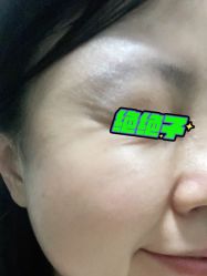 体验后-鑫元辰医疗美容整形