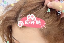 -大麦微针植发全国连锁