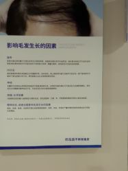 -碧莲盛不剃发植发