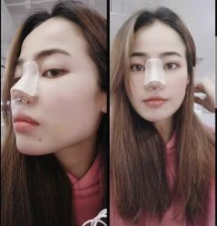 -北京米扬丽格医疗美容·联合丽格鼻整形中心