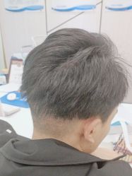 点击看大图 -碧莲盛·不剃发植发