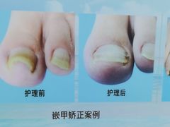 -世龙世家手足健康护理连锁(福田梅林路润裕花园店)