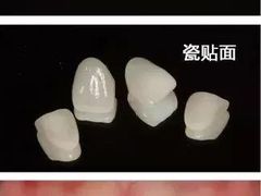 -团圆口腔·种植中心(锦江院区)