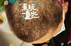 -大麦微针植发全国连锁