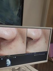 -苑苑vbeauty科技美容SPA