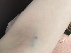 -上海中医药大学附属曙光医院(东部)