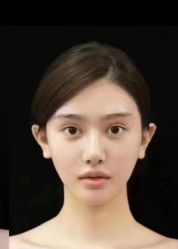 -郡艺医疗美容·微整·眼鼻吸脂