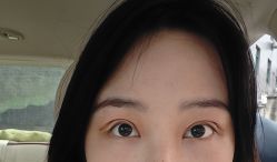 体验后-杭州美莱医疗美容医院