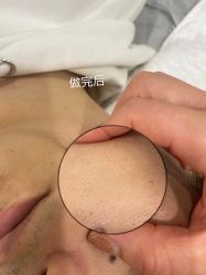 点击看大图 -美肤盾祛痘·问题肌头疗管理中心