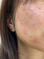 -广州曙光医学美容医院