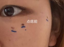 -美莱医学美容医院