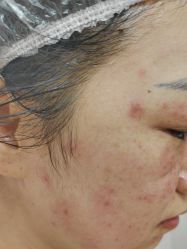 -长沙雅美医疗美容医院