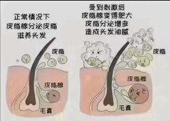 -诗碧曼养发