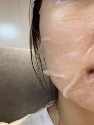 体验后-广州美莱医疗美容医院