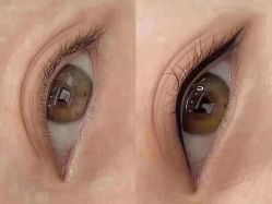 点击看大图 -睿明真达专业皮肤护理中心