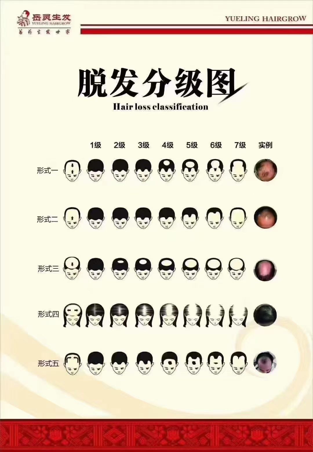 你是什么等级的脱发知道吗?