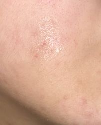 -万州华美紫馨整形美容医院