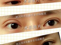 -华中科技大学同济医学院附属同济医院(汉口院区)