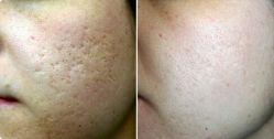 -SKINIST丽铂医疗美容