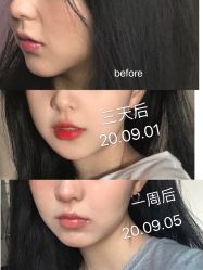 -上海漾颜医疗美容