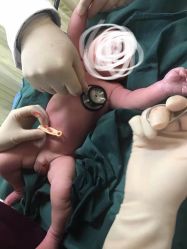 -杭州贝瑞斯美华妇儿医院·早孕·产检·儿科