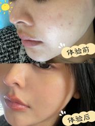 点击看大图 -广州健丽·去眼袋医疗美容机构