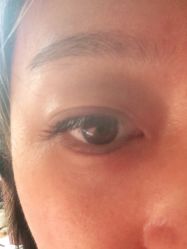 体验后-华臣医疗美容