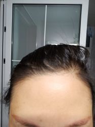 体验后-石家庄苏亚美联臣医疗美容医院