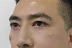 -天津健丽·去眼袋医疗美容机构