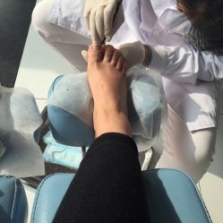 -派恩宜灰指甲·甲沟炎·鸡眼康护