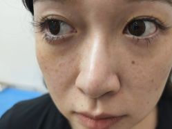 -广州美莱医疗美容医院