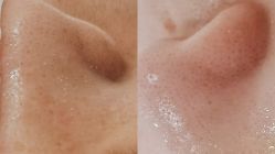 点击看大图 -skin79皮肤管理中心