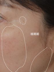 -清疣美疣·痣·斑净肤中心