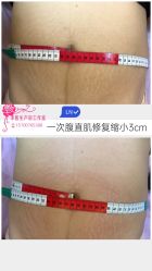 -阖美.纤思韵产后养护中心(长沙店)