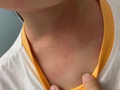 -安徽医科大学第一附属医院(绩溪路院区)