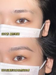 -OnFaer.纹眉半永久无创洗眉