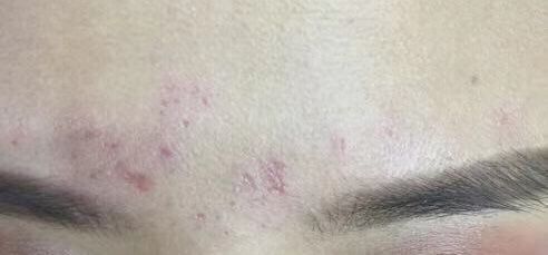 -YOUNGSKIN氧研皮肤管理中心