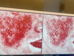 -苑苑vbeauty科技美容SPA