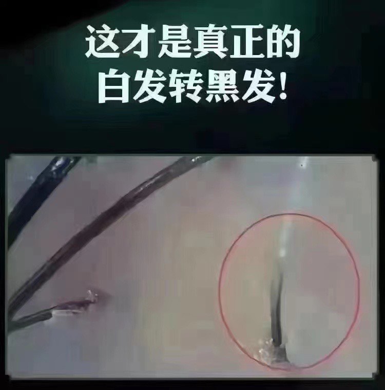 大同物理植发(大同物理植发医院)