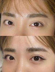 点击看大图 -美愈美肤MEIYU SKIN