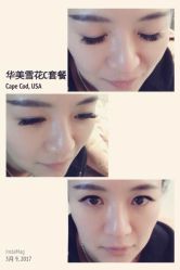 睫毛嫁接-光SPA科技美肤