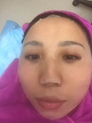 -北京米扬丽格医疗美容·联合丽格鼻整形中心