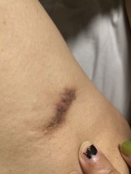 -杭州米兰柏羽医疗美容医院