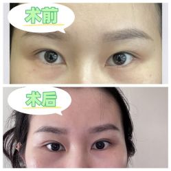 -素美医疗美容·西南眼鼻整形·修复基地
