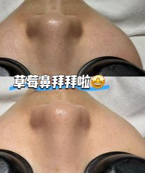 -宥莉·ULLY 痘敏肌•科技皮肤管理中心