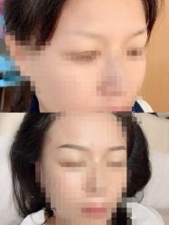 -久匠·纹眉纹绣半永久